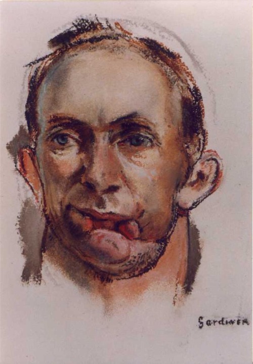 lepromatosis:Pastel portraits done by Henry Tonks, an artist and former surgeon who drew the patient