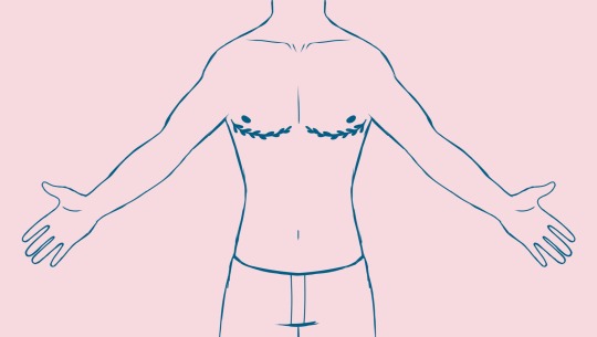 Hungarian top surgery fund, organized by Zoë Shreckengost