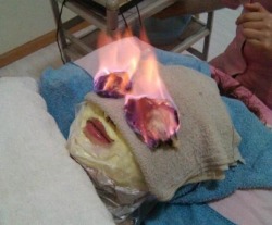 There’s a beauty treatment in China called Huǒ liáo that’s meant to brighten your face… by setting it on fire. A towel is soaked in a “secret elixer” (a.k.a. lighter fluid) and then placed on the problem area. Alcohol is added as a starter