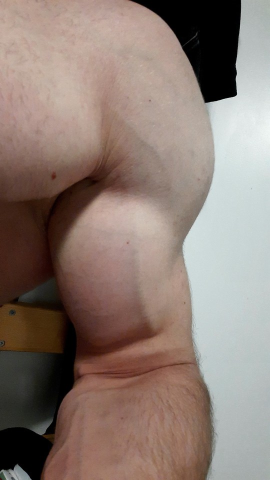 Pull Day. The Scale Is Not Going Up As Hoped, But I Think There's Some Improvement In Definition And