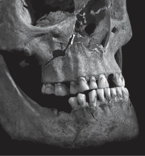 medievalistsnet:Nine blows to the head killed Richard III, study finds