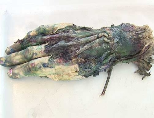 “Tthe hand that never stopped painting ” Morten Viskum used a hand from a corpse as a paint brush. 