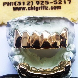 chigrillz-goldteeth:  #classic #solid #gold #removable #pullout #slugs #goldteeth #golds #fronts #grillz #10k #14k #yellowgold #goldmouth #mouth #teeth #jewelry #instagrillz #chigrillz