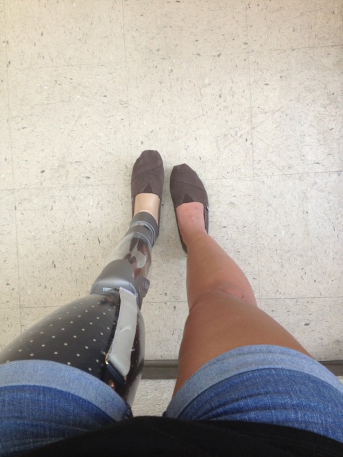 stephmmmm: I love my robot leg. I also love the fact that I am so comfortable showing it off. I can&