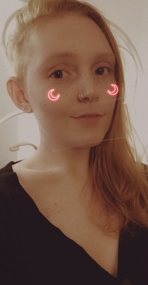 mossy-vulpes:I haven’t been feeling myself lately so have a dreaded filter selfie ft. subtle rope marks from this morning’s suspension✨they/them✨