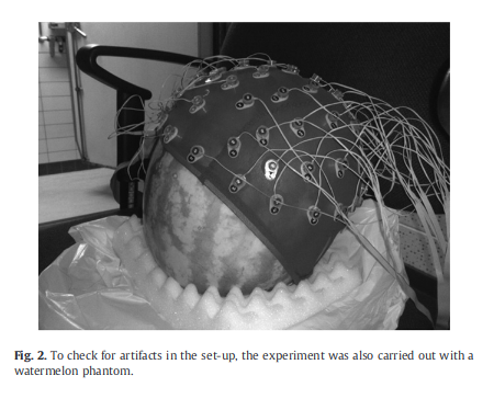 existentialterror: I haven’t read neurology papers before and I’m dying(source)