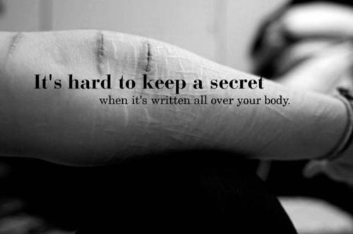 beingaselfharmer:  ..