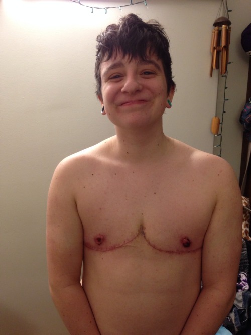 skwagger:Here’s some body positivity for Trans Day of Visibility. I never thought I’d EV