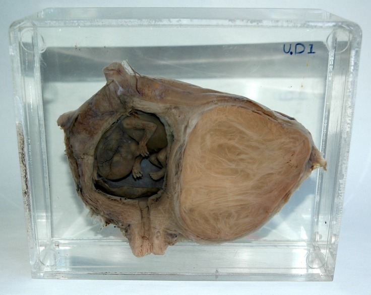 This particular specimen belongs to UCL Pathology Collections, and is currently on