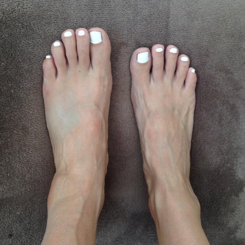 hippie-feet:Update on my injured footsie…