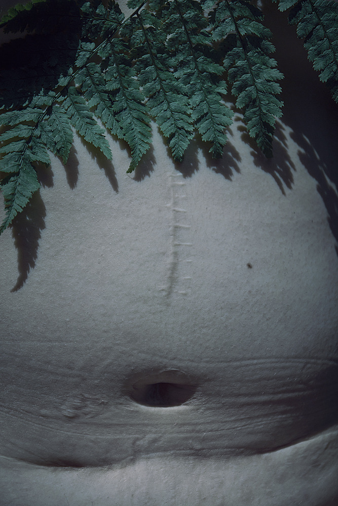 elenahelfrecht:  A Fragile Warrior. FacebookWebsite 
