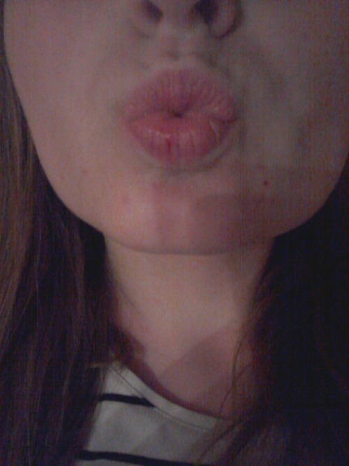 Bloody lips