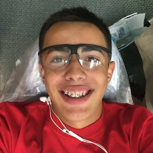 braces on males