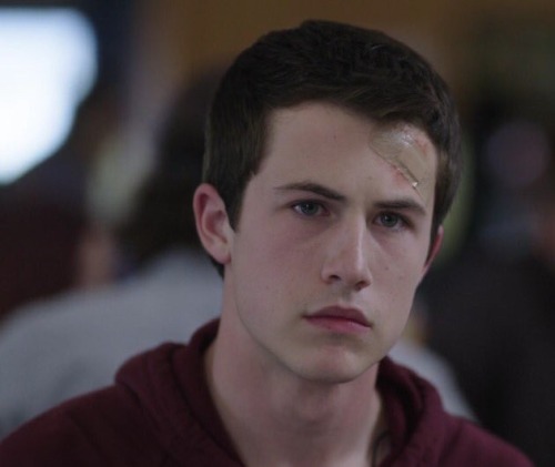 Dylan Minnette: prone to forehead injuries, must protect at all costs