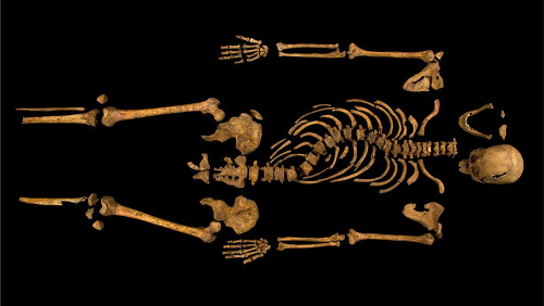 xmorbidcuriosityx: Richard III: The twisted bones that reveal a king When Richard was killed at th