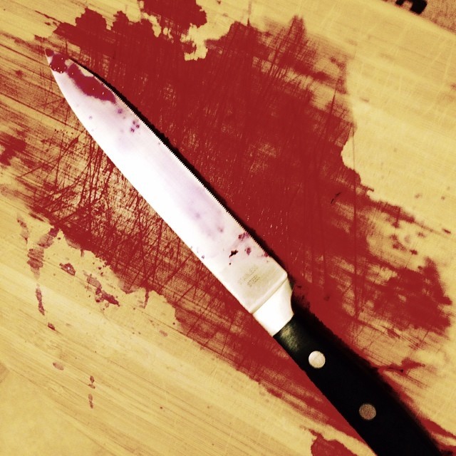 It’s a bloodbath in here today #blood #knives #cooking #bloodbath #bloodysunday