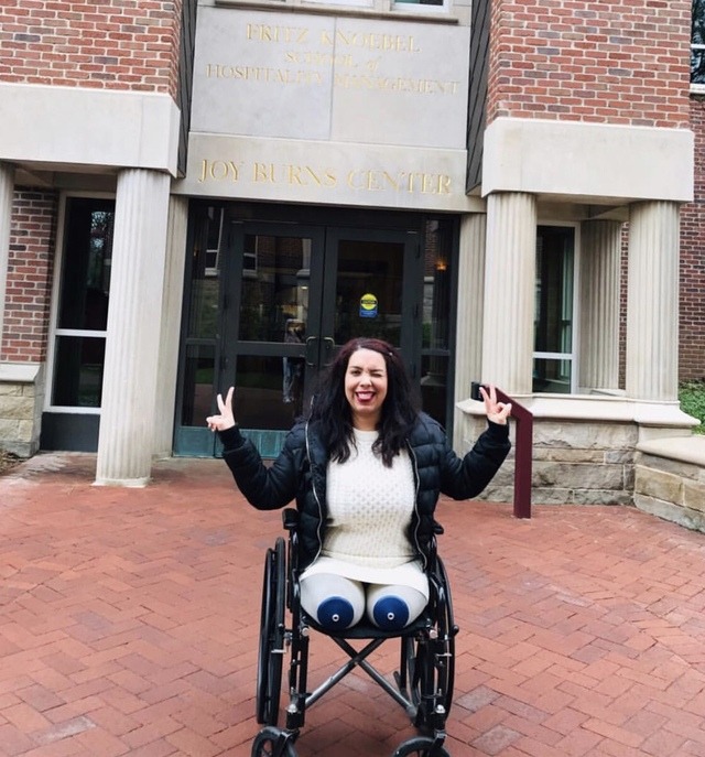 Quad amputee