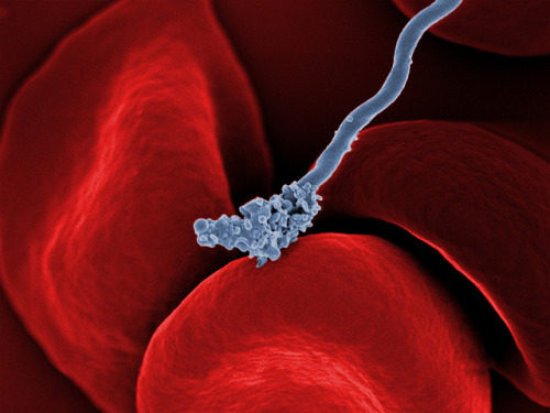 Relapsing fever bacterium (gray) on red blood cells | ZEISS MicroscopyThe long, spiral-shaped bacter