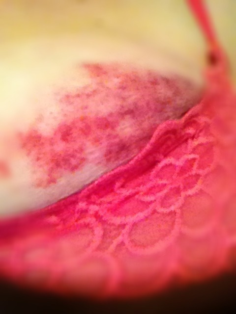 justastrumpet:  I’m really proud of my playtime bruises.  I want pretty, playtime