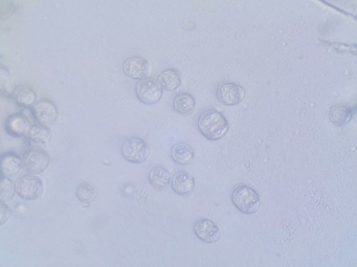 An Oomycete called Pustula obtusata (fungus-like eukaryotic organism) causing chlorosis on Inula sal