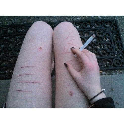 HUMAN ERROR