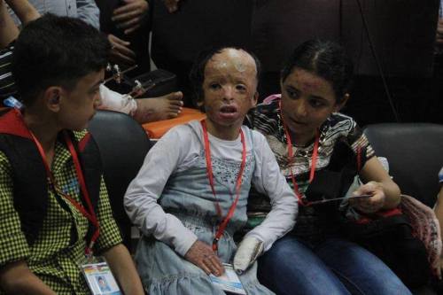 famee:  merelypassion:  golden-spoon:  beinpalestine:  This is what ‪Israel‬ inflicts on children in ‪Gaza‬. But it doesn’t matter to the media because ‪US‬ is an ‪Israeli‬ client  ياارب احرق اليهود، يارب اشوف