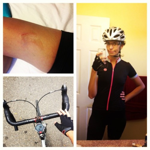 likelytovanish: Round two today! Fell again and it looks like an animal clawed me, haha. It’s not as