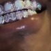 drexdnd:Smino