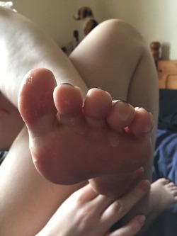 ellessexyfeet:  More aftermath pics