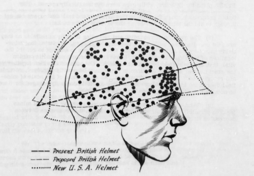 ratak-monodosico:HEAD WOUNDS &amp; STEEL HELMETSIn the March, 1943 edition of the US Army’