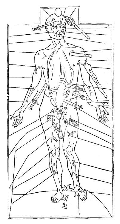 Wound Man, 1495