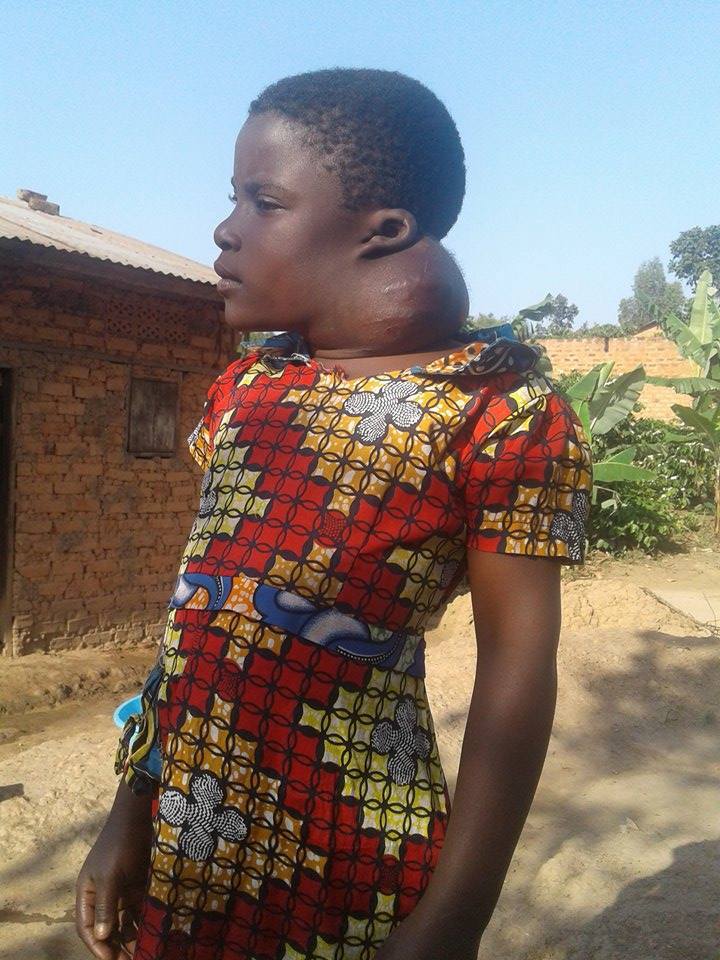 Click here to support Batwa Indigenous Orphan adult photos