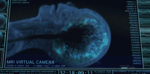 This Is Someone Dying While Having An MRI Scan. Before You Die, Your Brain Releases Tons And Tons Of