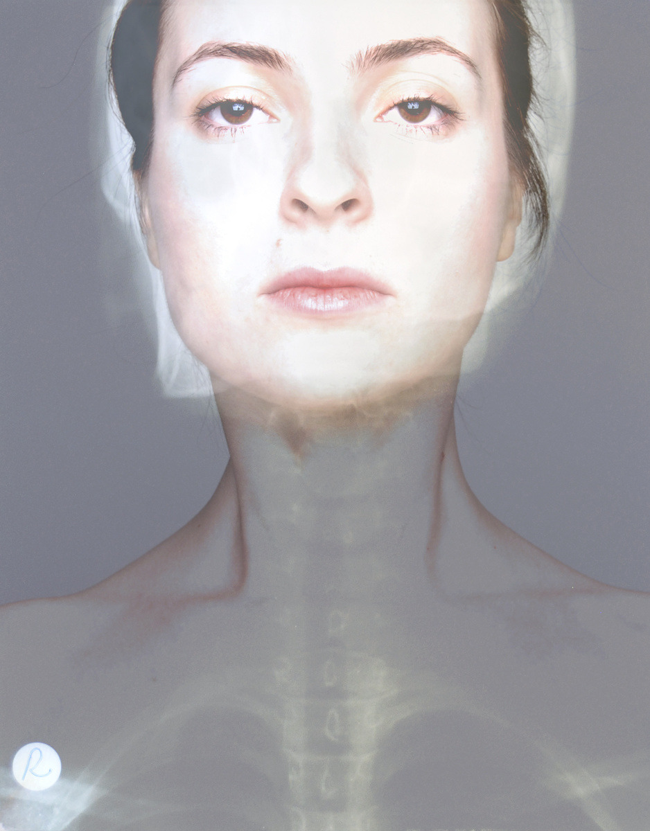 asylum-art:  Inside-Outside:  X-ray self portrait  by Dilek Öztürk on Behance