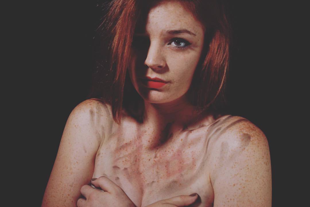 Naked Freckles Tumblr