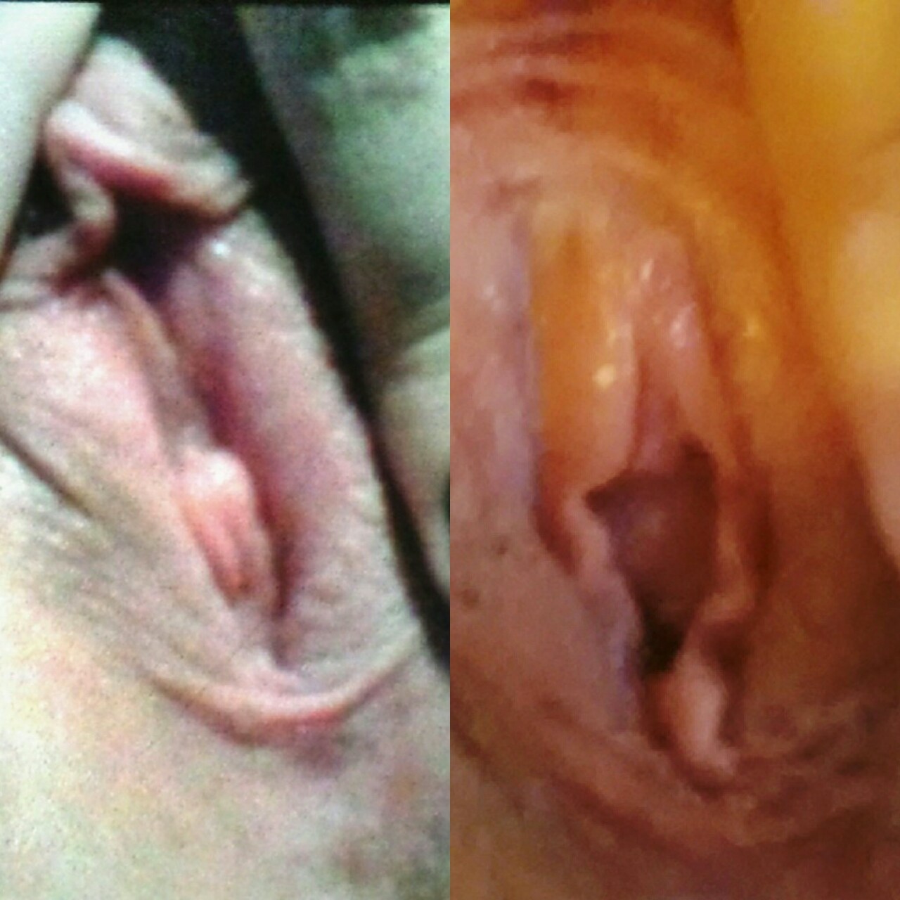 loveatfistsite:  My ‘before stretching’ picture is on the left and my &lsquo;after