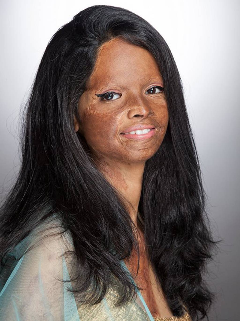 redsuelo:  amberrosehairline:  myvoicemyright:   Acid attack survivors in India model