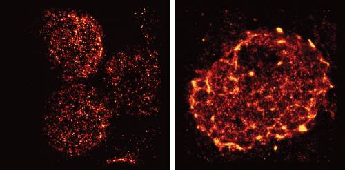 Salk Institute researchers have just given us all a new view of immune cells using super-resolution 