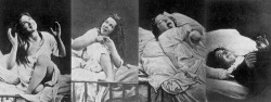 A series of photographs from the 1870s of a woman apparently “suffering” from female hysteria, that is, “a tendency to cause trouble,” whilst under hypnosis.
