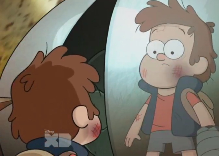 llttledipper:  okay but Dipper’s constellation birthmark is showing up a lot, and