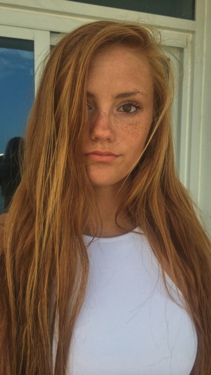 vscosgreatest: Alyssa W. Never examined a ginger’s abdomen. Would love to start with this one!