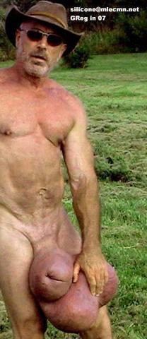 A handsome sexy looking man and with an awesome siliconed package.  He is one of