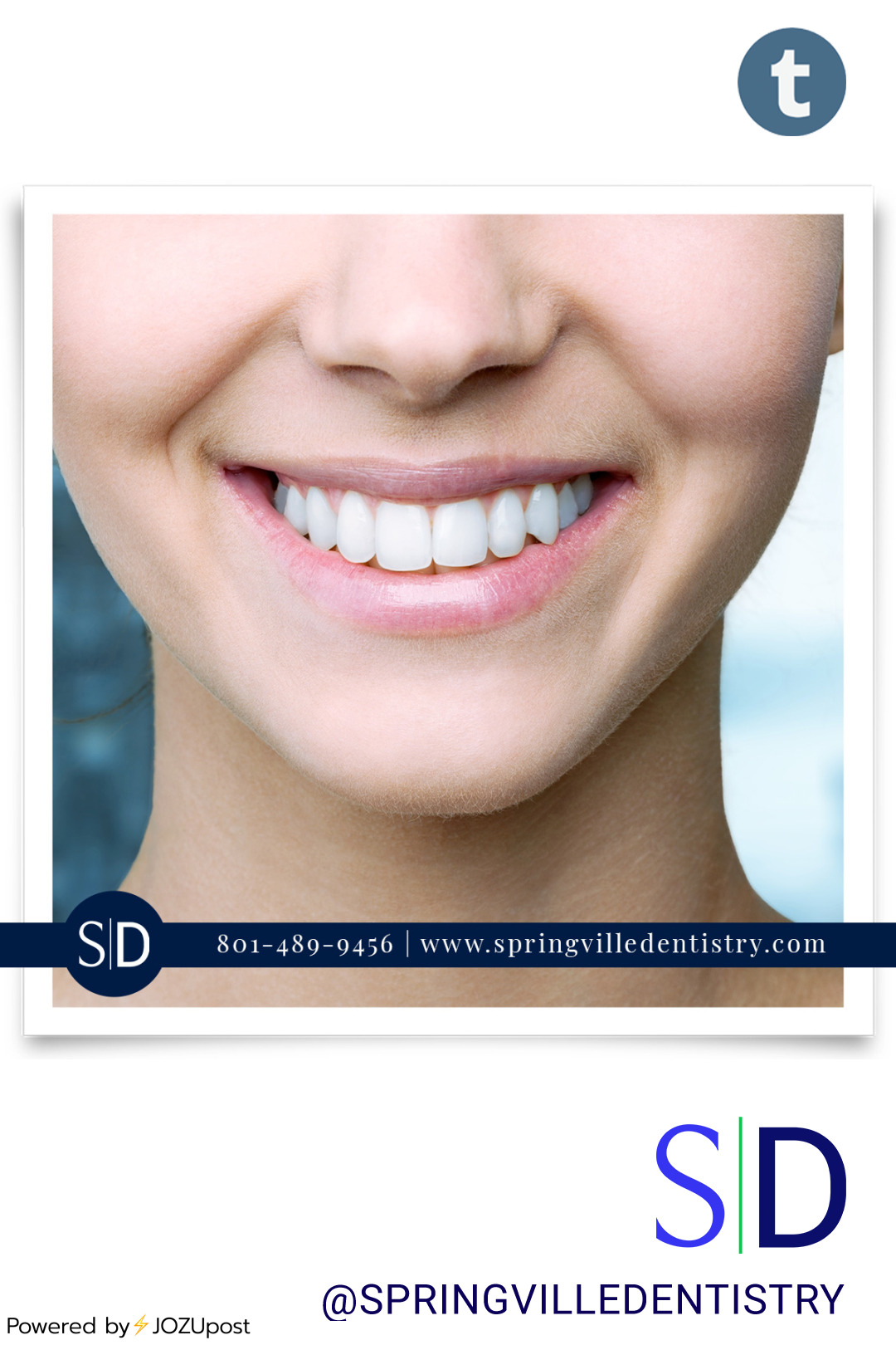 What are dental veneers?
They are thin shells of porcelain or composite resin custom-made to fit over your teeth.
These veneers enhance your appearance by bonding to the front surface of your teeth.
Why choose dental veneers?
Stained, chipped, or...
