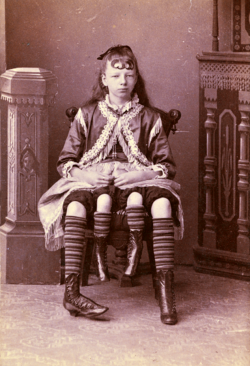Josephene Myrtle Corbin, the Four-Legged Woman, was born in Lincoln County, Tennessee in 1868.
