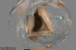 almostdrchelsearar:  futuredoctorjen:  postgrad-premed:  thisfuturemd:  acethishit-study:  aortic valve in action, it kinda looks like a screaming mouth  WAAAAAAAAA! WAAAAAAAAAAA!  What is the arrow pointing to?  ^^ the origin of the coronary arteries