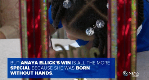 veryfemmeandantifascist:  blackademics:  micdotcom:  Virginia girl without hands