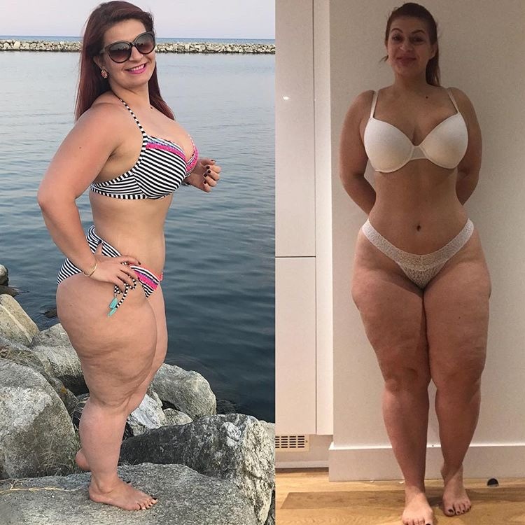 my-thick-pics:  Ioana