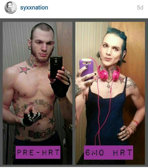 tsaucey: pyromantix: fr33tobm3: Inspiring HRT journeys from Instagram and Tumblr. Estrogen and Testo