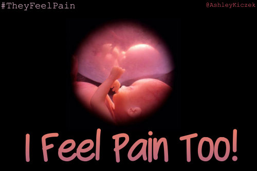 They feel Pain too, Let us be a voice for those who do not have a voice! Join us in the #TheyFeelPai