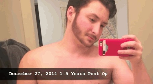 Austin null leaked photos